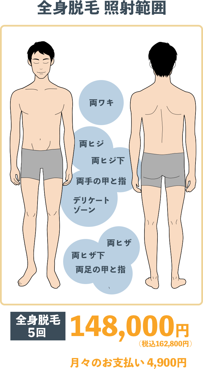 全身脱毛　適応部位